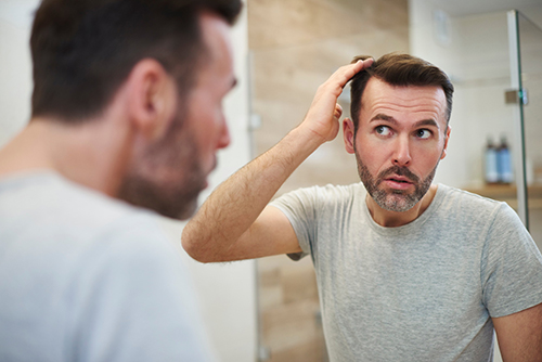 men-hair-loss