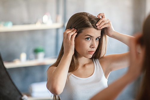 women-hair-loss